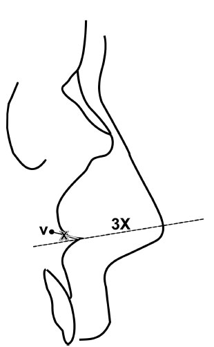 art31 f2